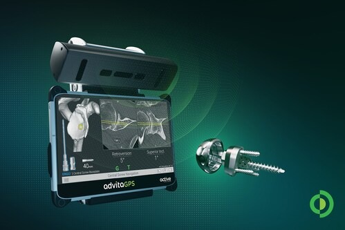Advita GPS™ supports central screw baseplate placement during the first GPS-guided shoulder arthroplasty case, representing the only technology designed to provide guidance for this procedure.